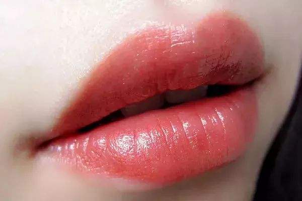 唇形有哪几种 什么是自体脂肪丰唇术